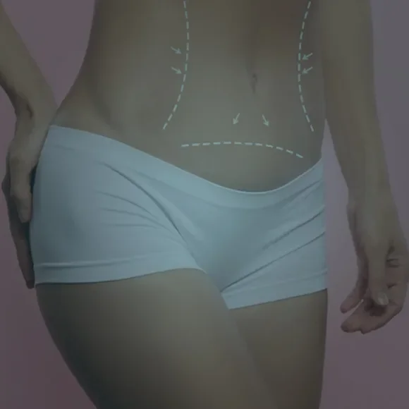 Botox gastrico
