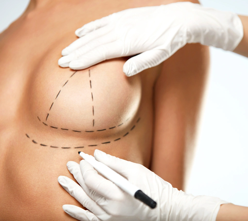 4. Recupero post-operatorio