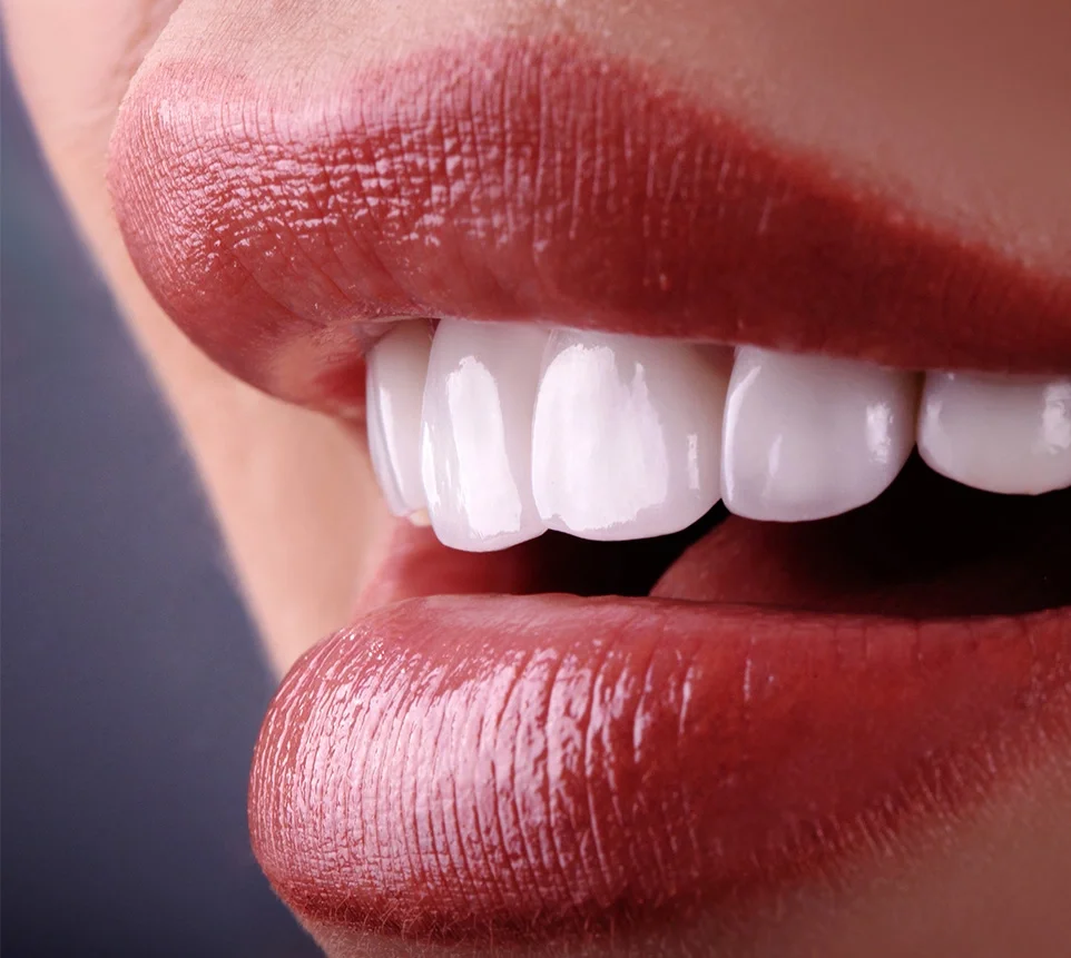 Trattamento con corone dentali