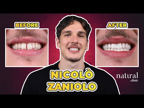 Nicolò Zaniolo Testimonial