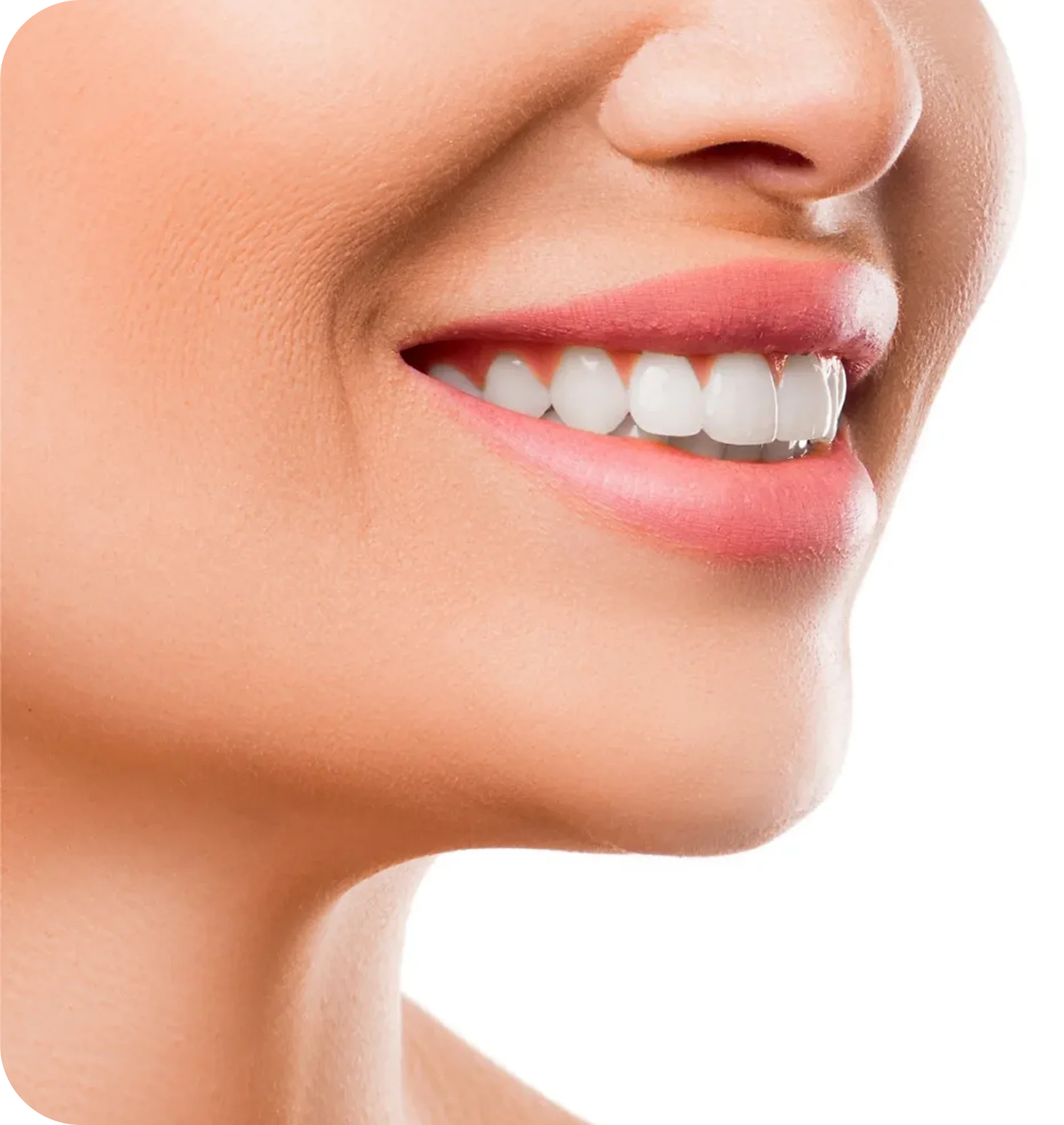 Processo di trattamento delle faccette dentali in Turchia