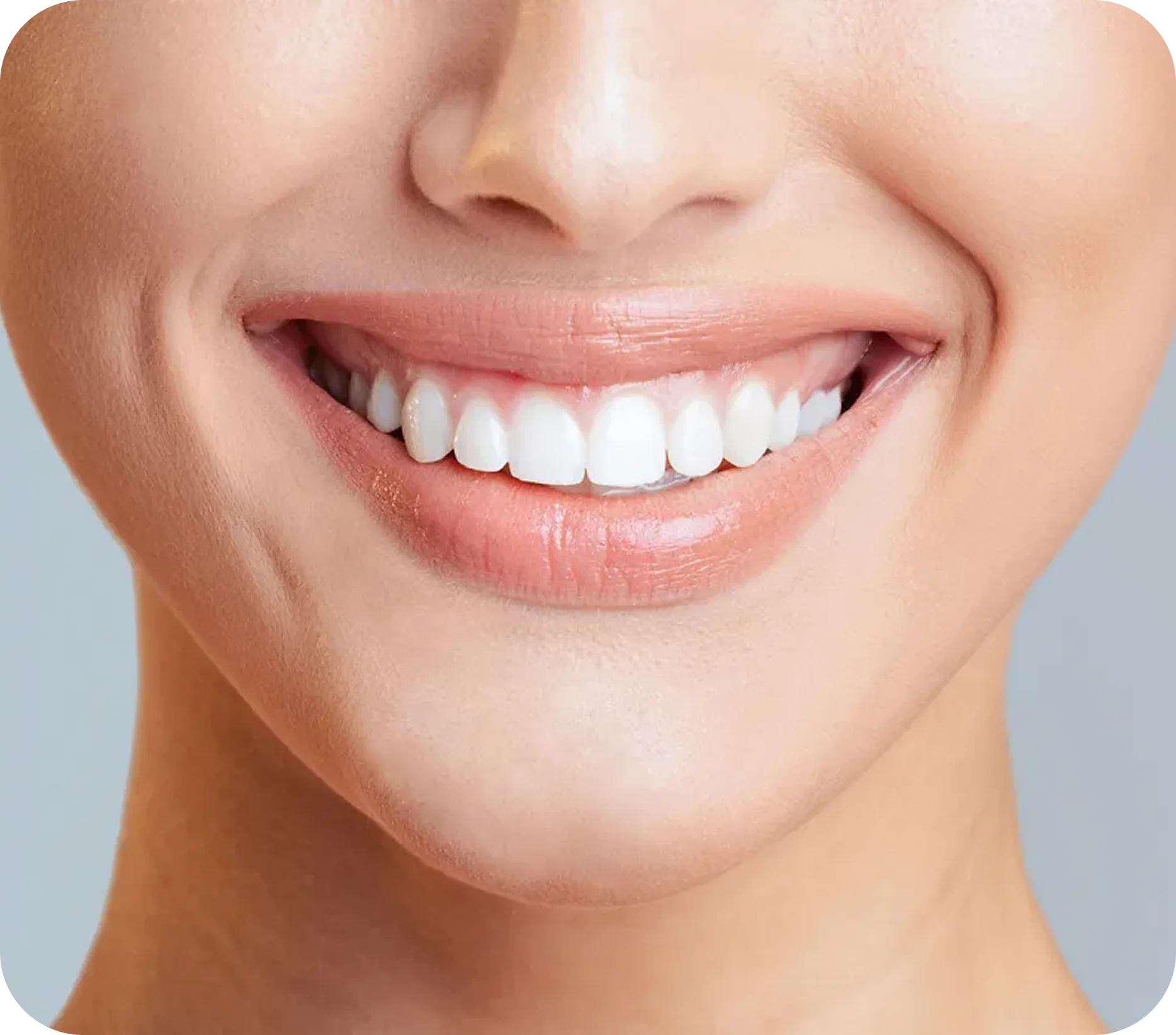Confronto tra le opzioni di faccette dentali
