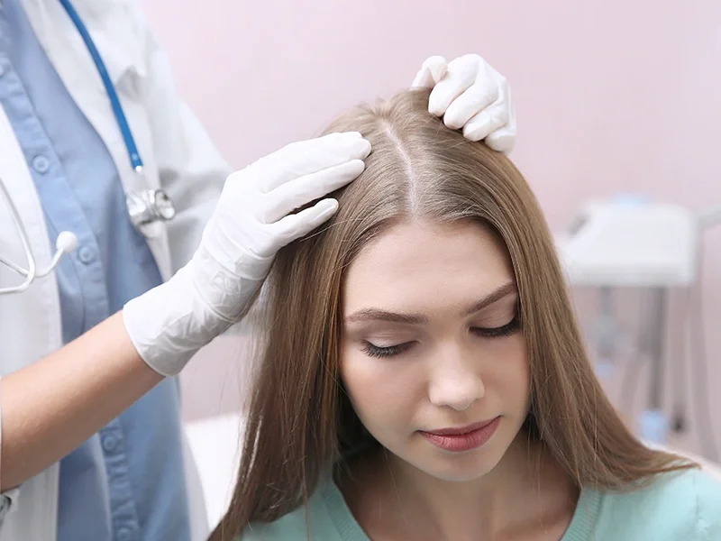 Recupero del trapianto di capelli femminile