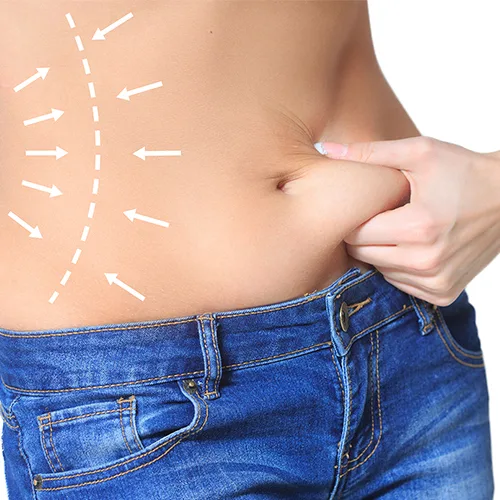 4. Assistenza post-procedura