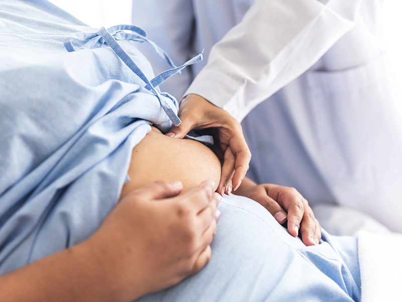 Bypass gastrico Roux-en-Y (RYGB)