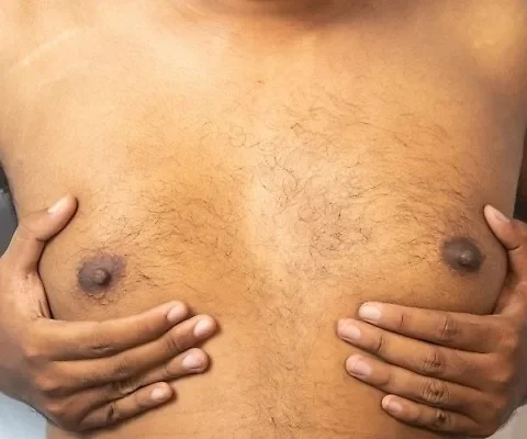4. Cure post-operatorie