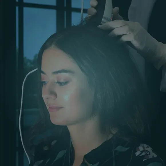 Trapianto di capelli femminile