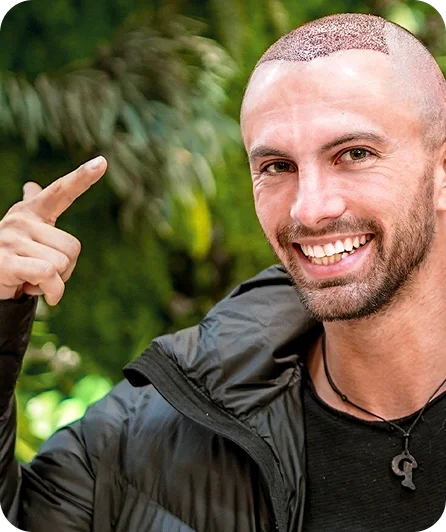 Candidato al trapianto di capelli
