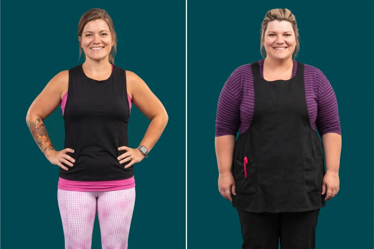 Weight Loss Surgery 10