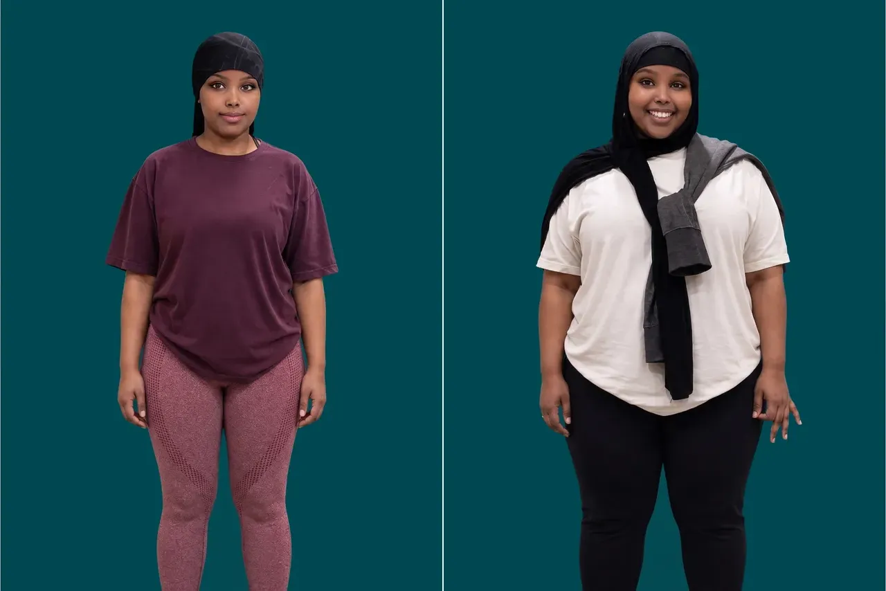 Weight Loss Surgery-Gastric Bypass 3