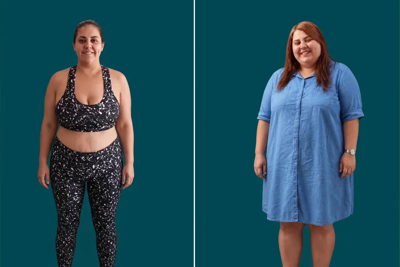 Weight Loss Surgery-Gastric Balloon 1