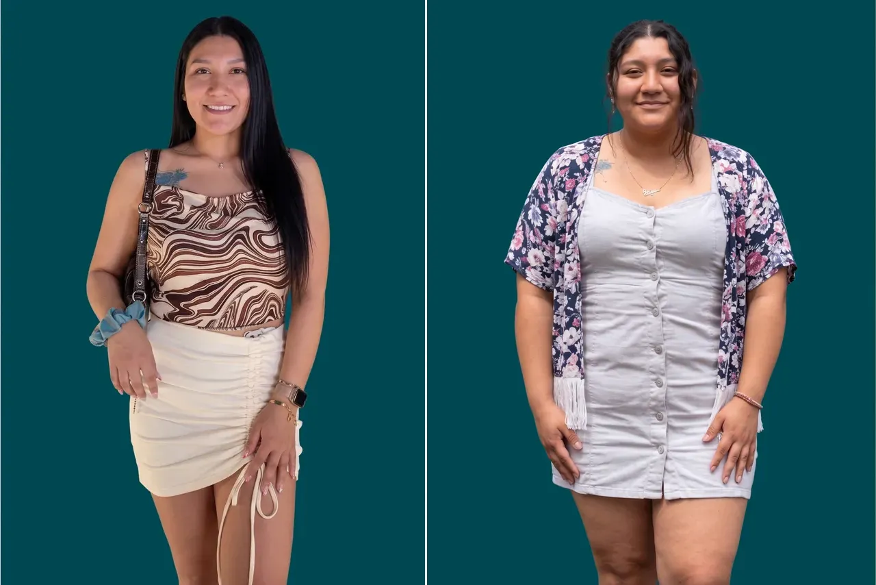 Weight Loss Surgery 7
