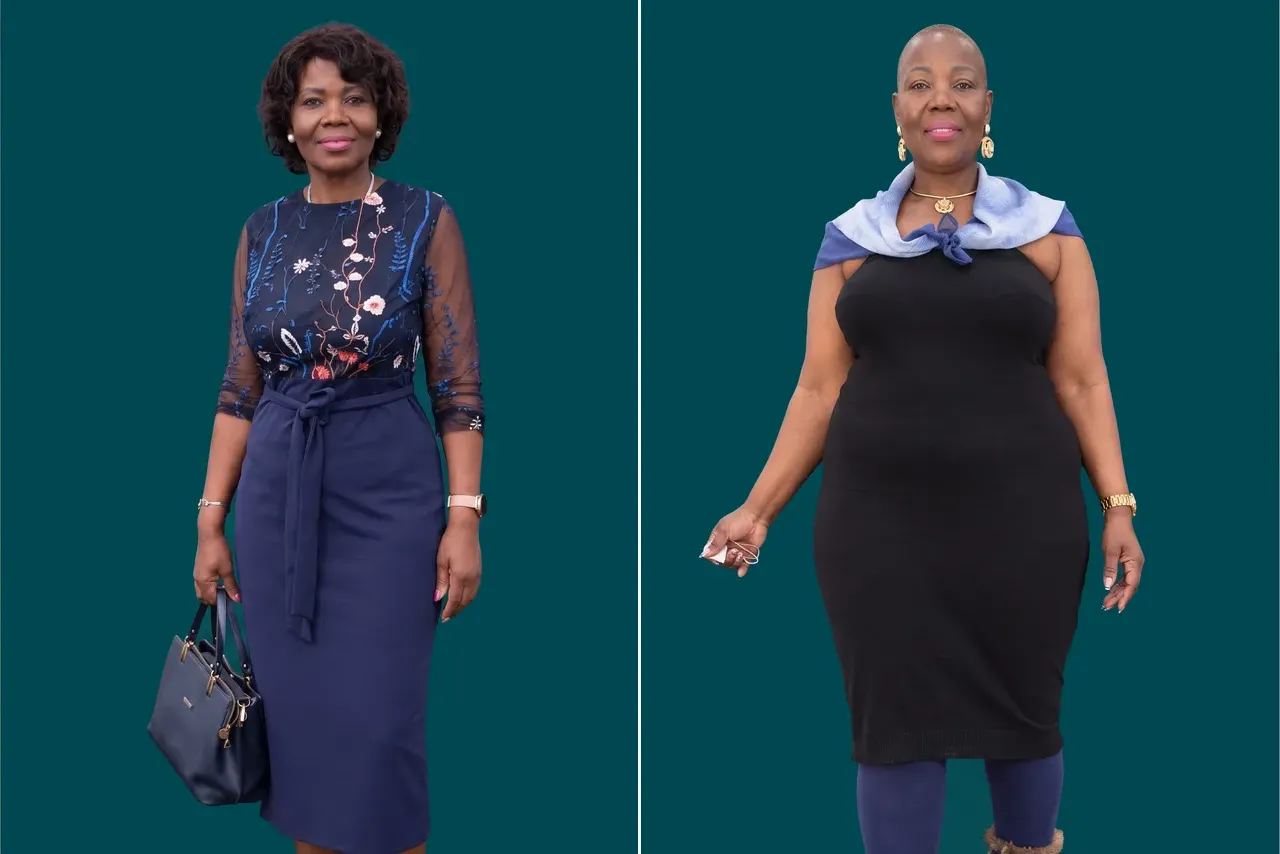 Weight Loss Surgery 8