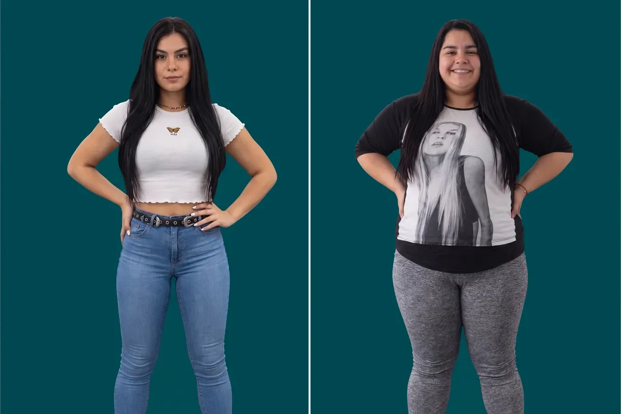 Weight Loss Surgery 9