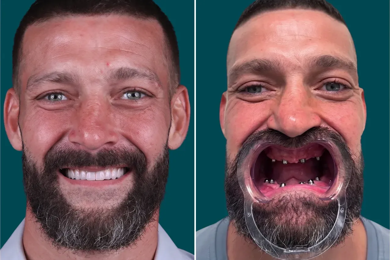 Smile-Makeover 2
