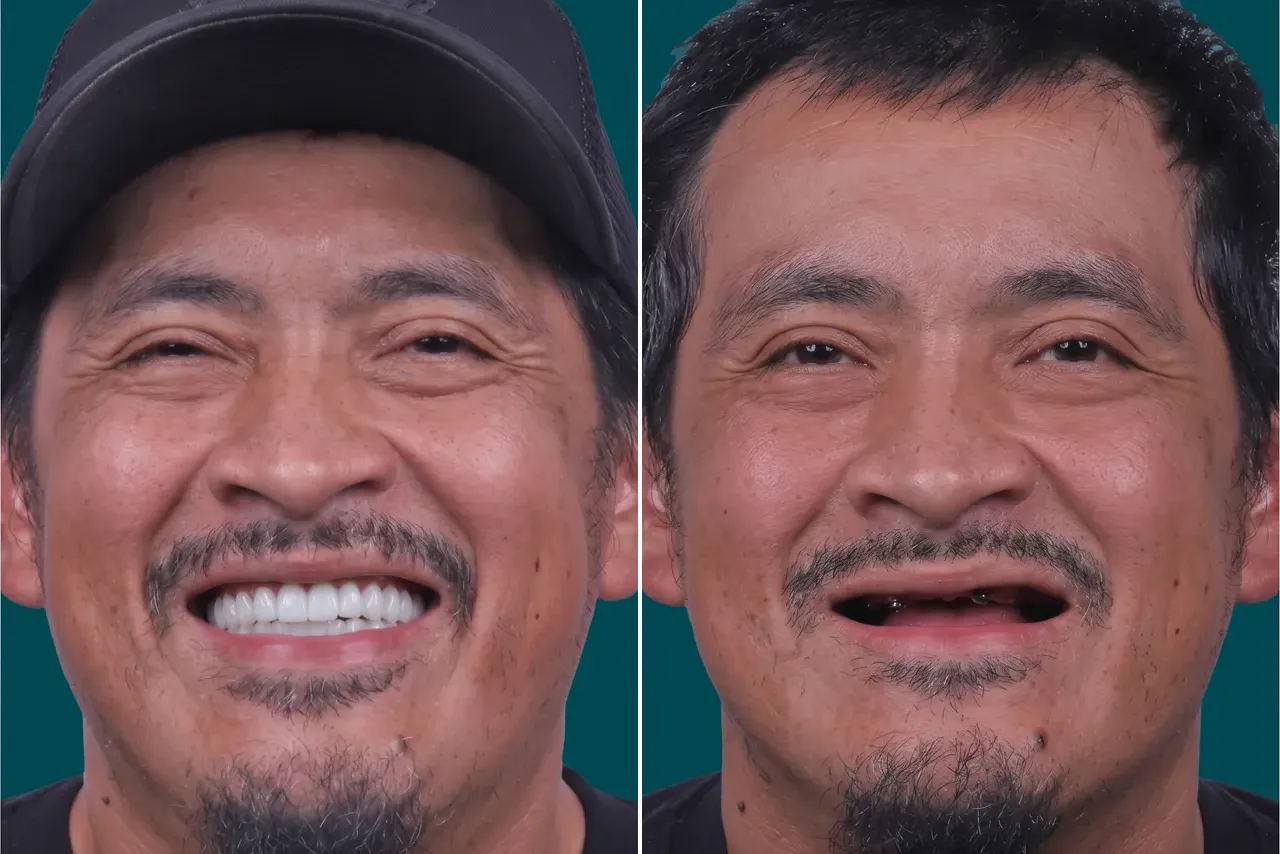Smile-Makeover 3