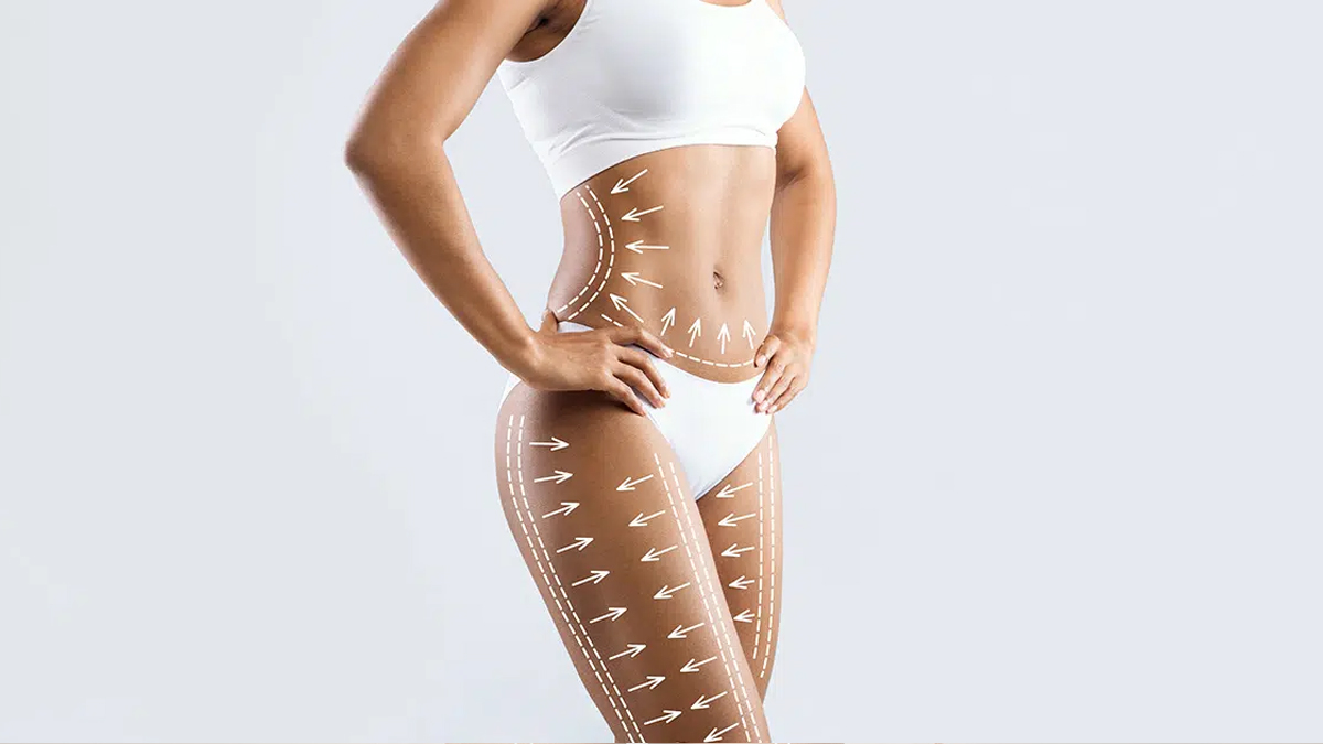 360 Liposuction in turkey