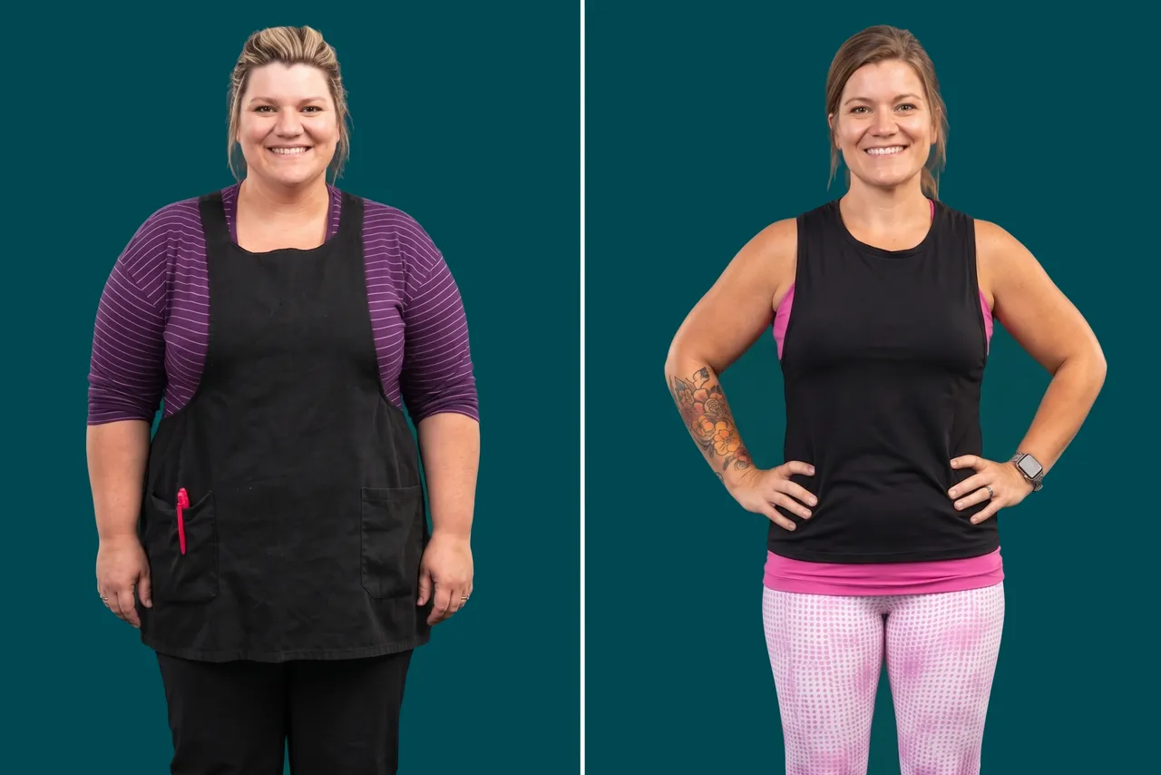 Weight Loss Surgery 10