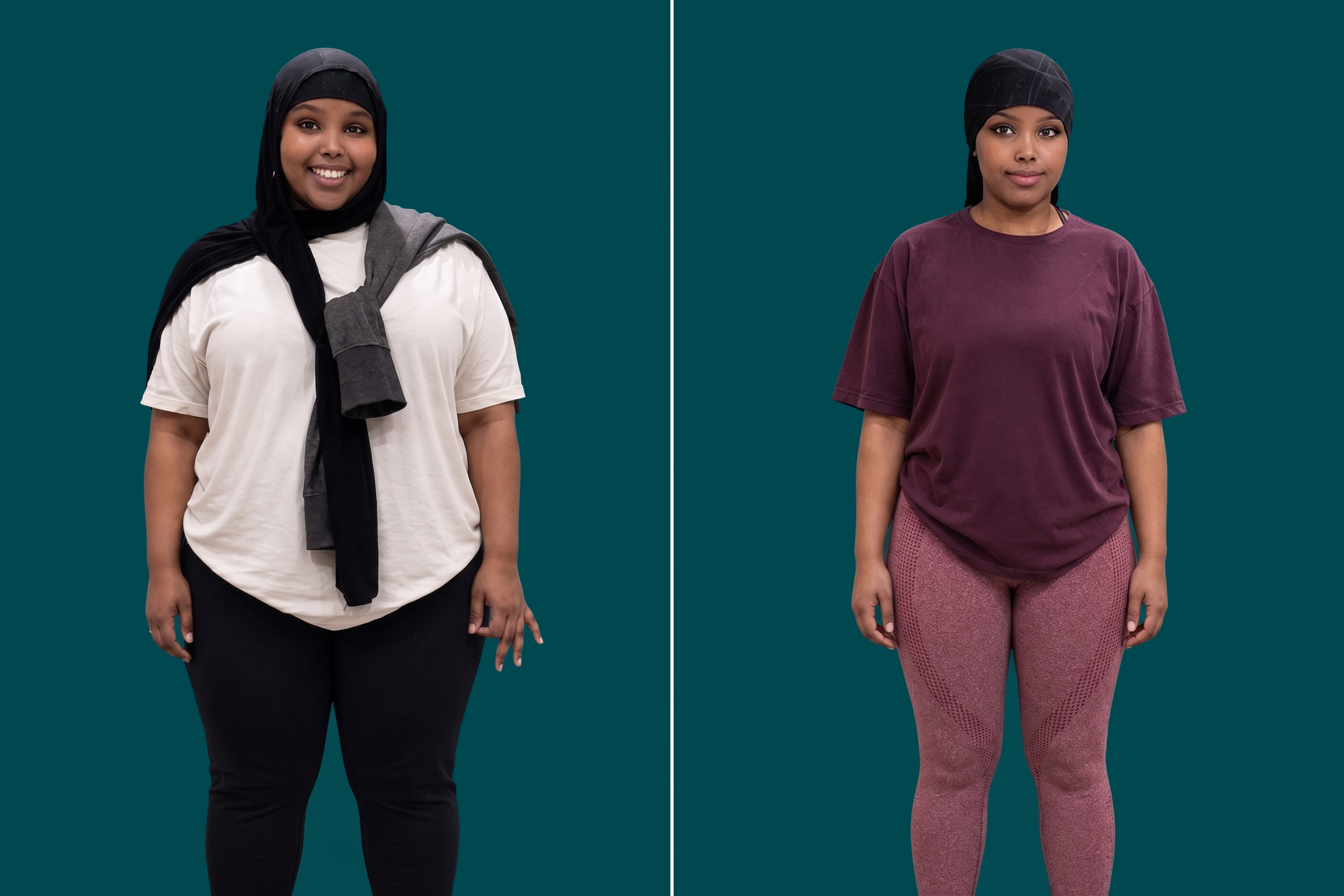Weight Loss Surgery-Gastric Bypass 3