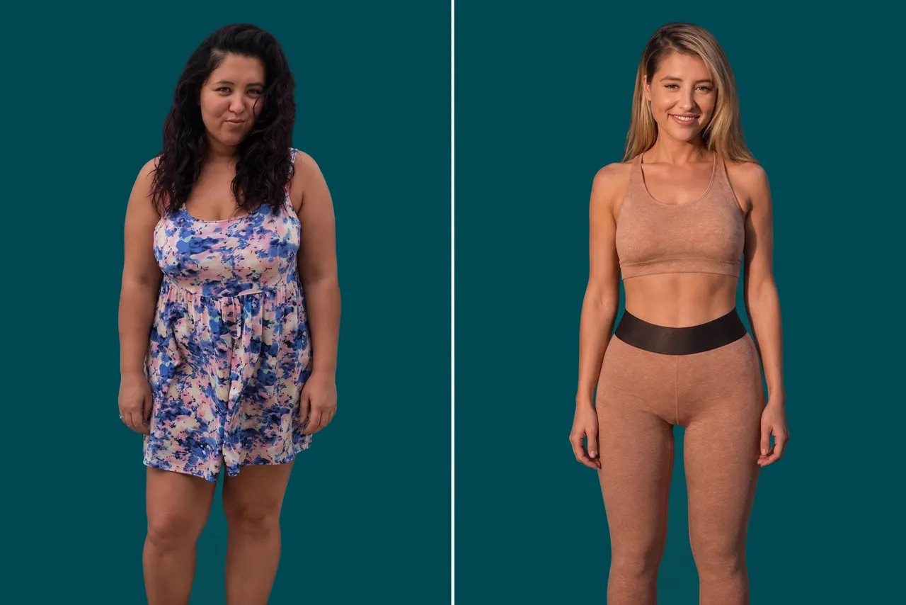 Weight Loss Surgery-Gastric Balloon 2