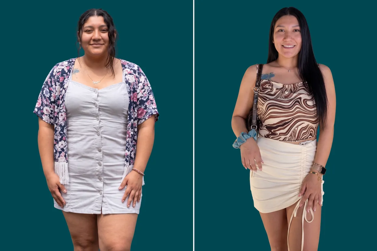 Weight Loss Surgery 7