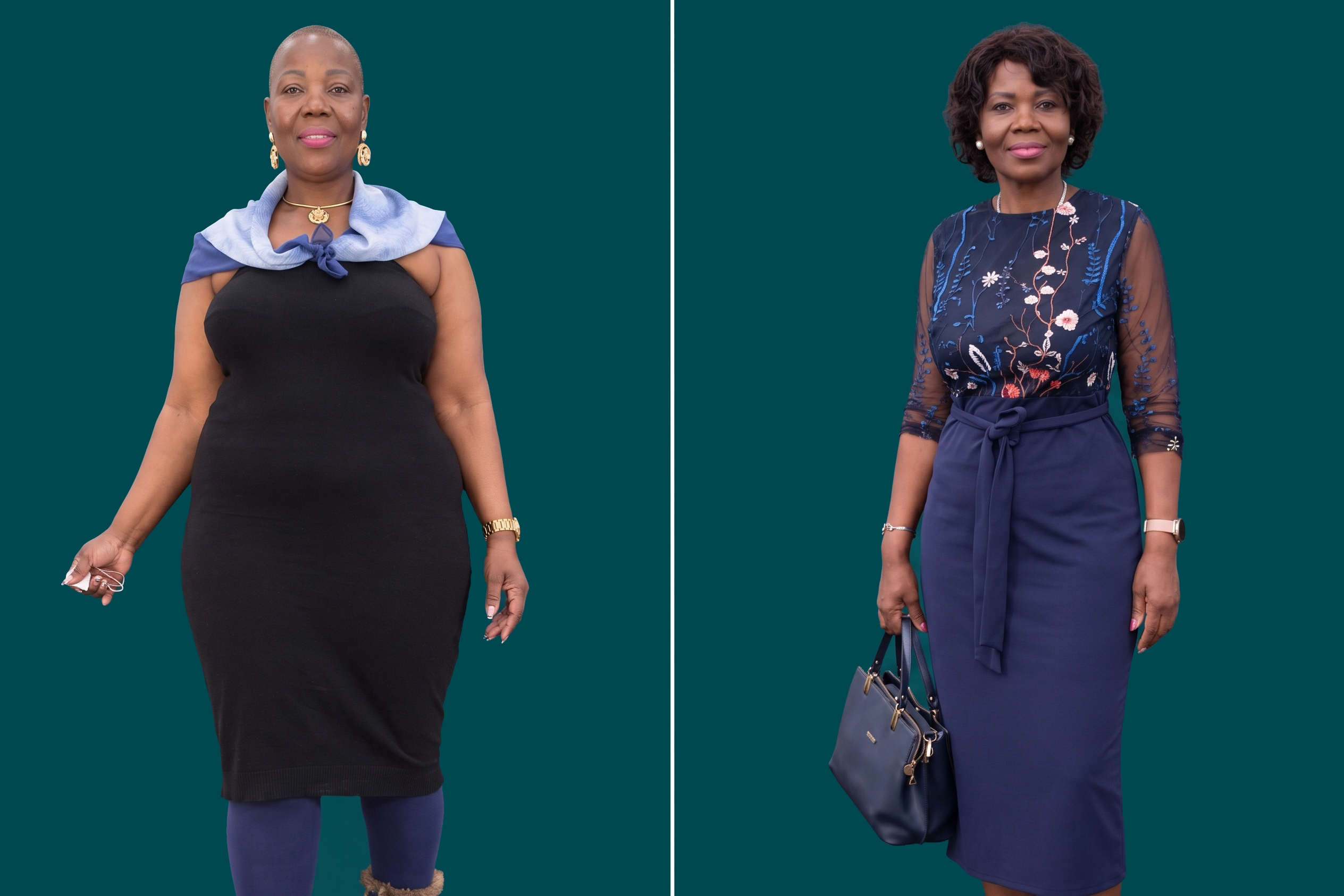 Weight Loss Surgery 8