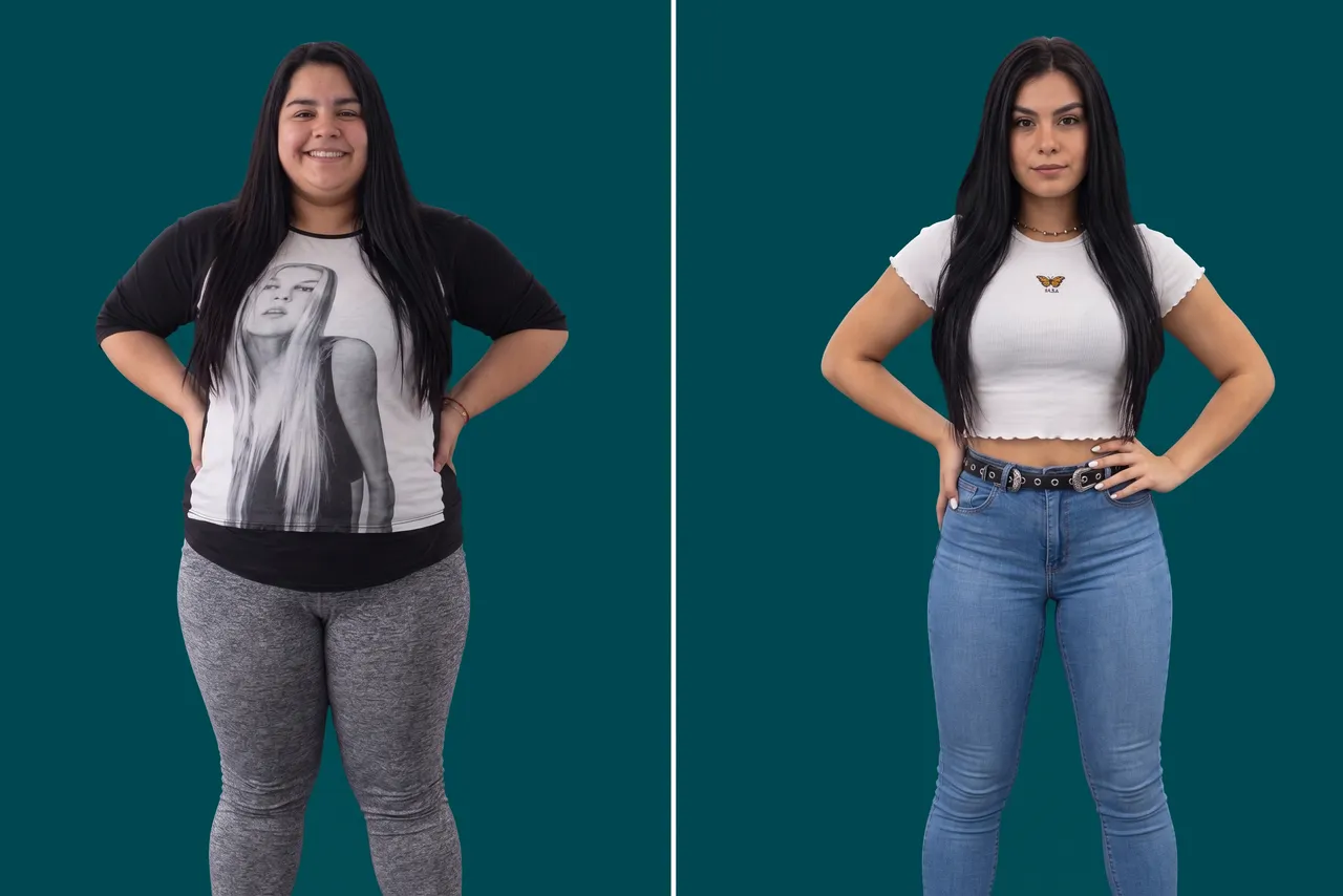 Weight Loss Surgery 9