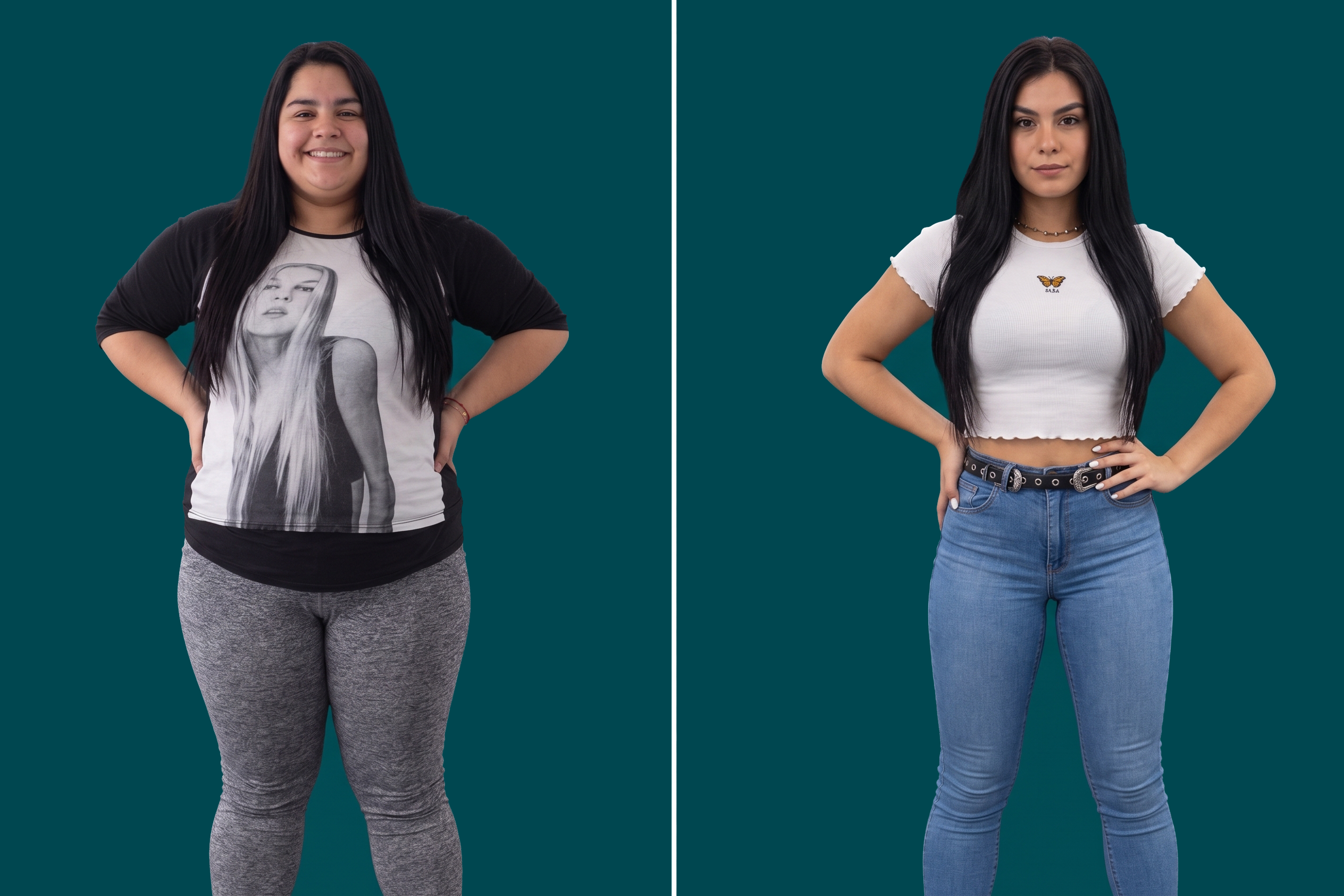 Weight Loss Surgery 9
