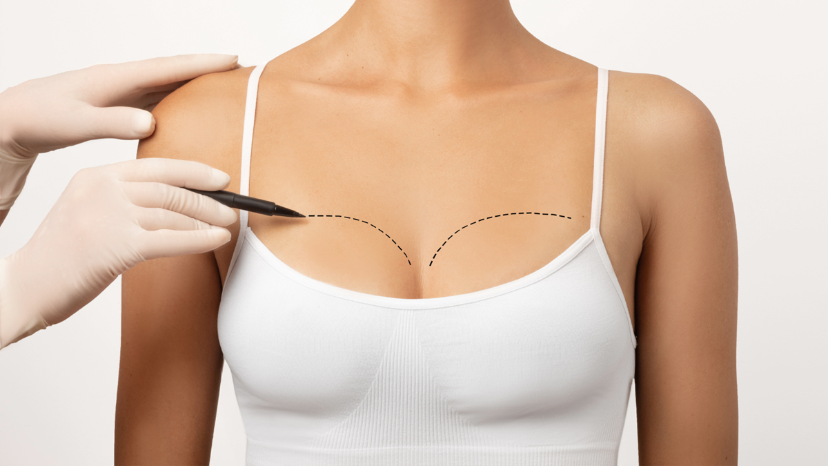 Breast Revision in Turkey