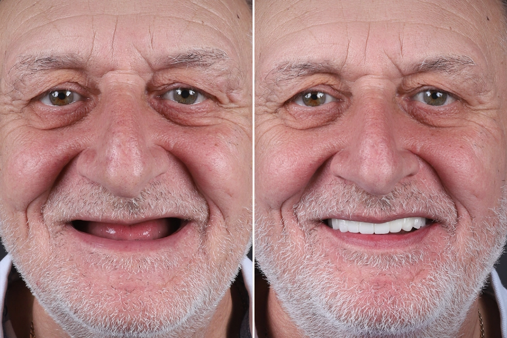 Before treatment