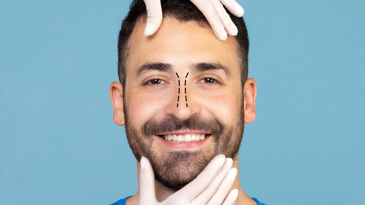 Male Rhinoplasty in Turkey