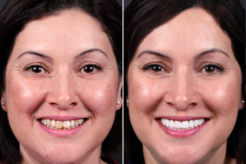 Before treatment