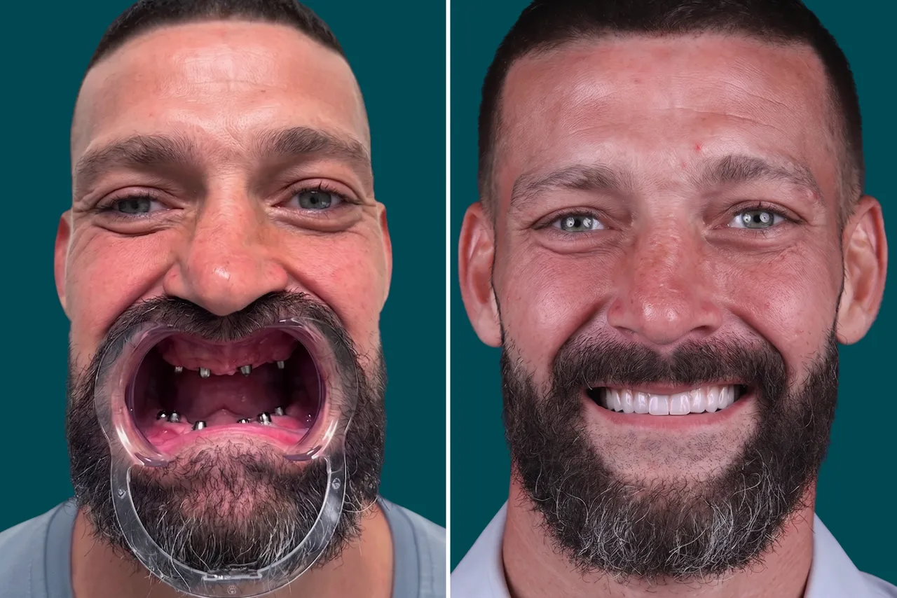 Smile-Makeover 2