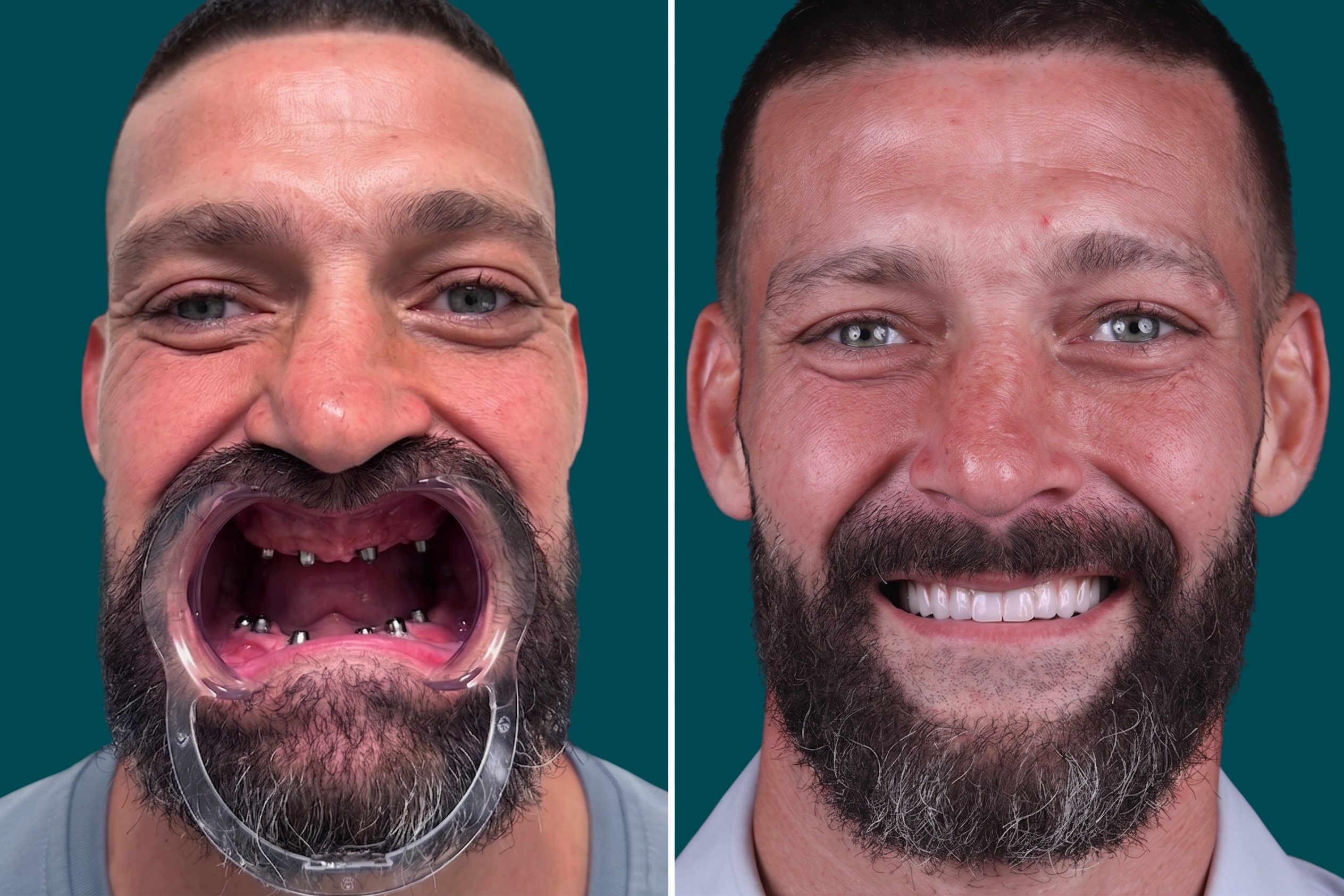 Smile-Makeover 2