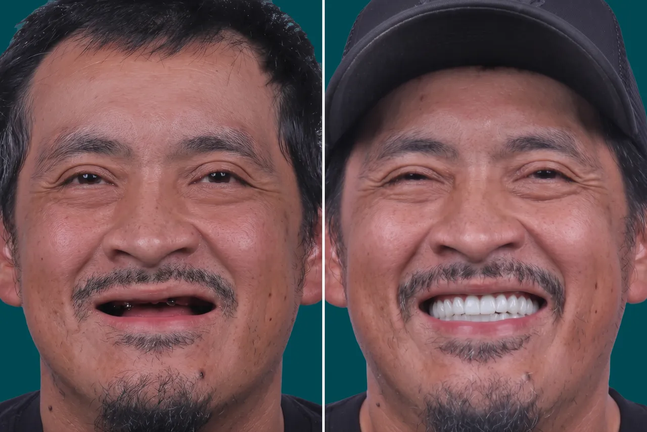 Smile-Makeover 3