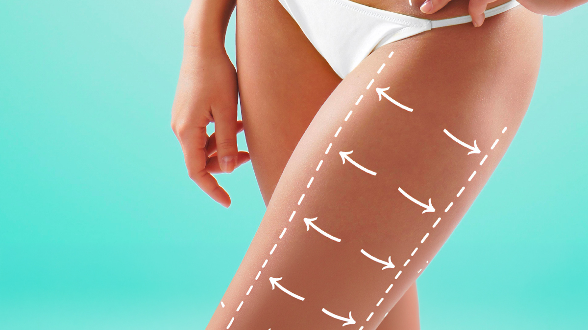 Thigh Lift in Turkey