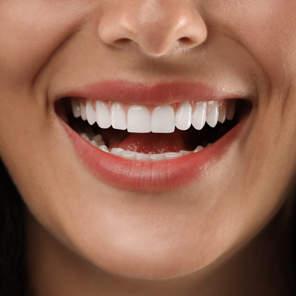 Why people are choosing Dental implants in Turkey