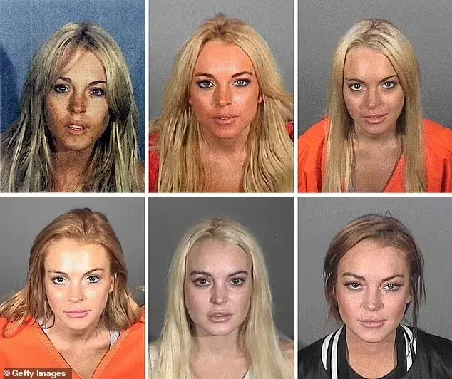 Lindsay Lohan before and after aesthetic transformation facial changes natural results