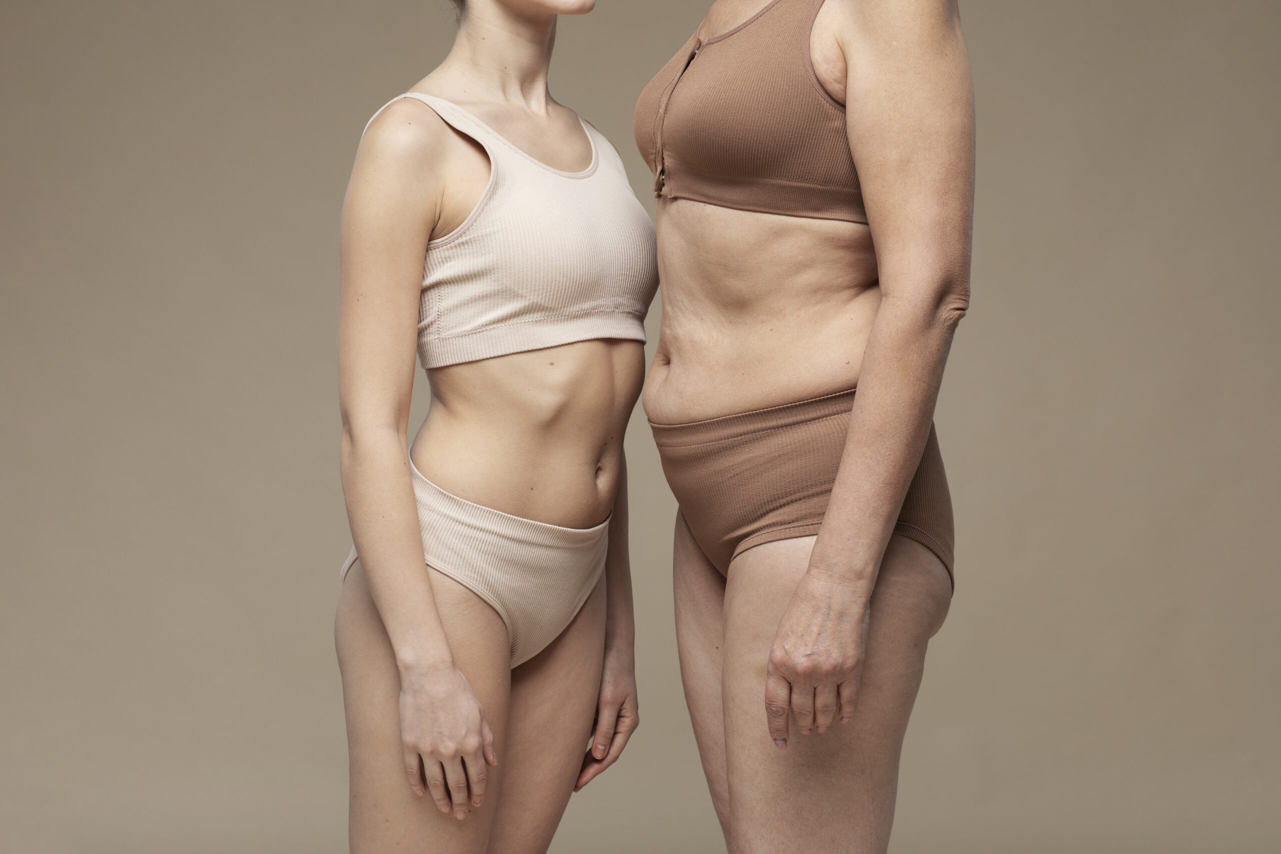 tummy tuck vs liposuction before and after comparison showing belly fat and loose skin results