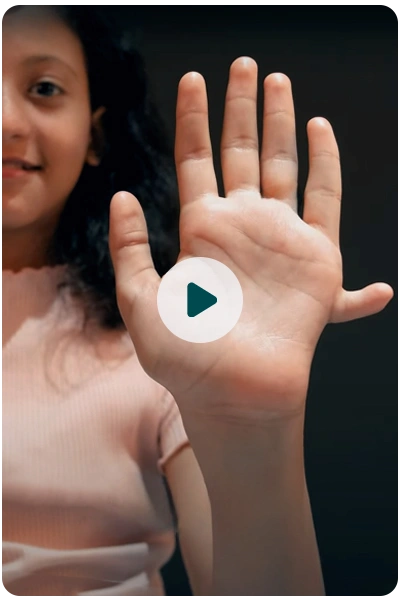 6 Fingers patient video
