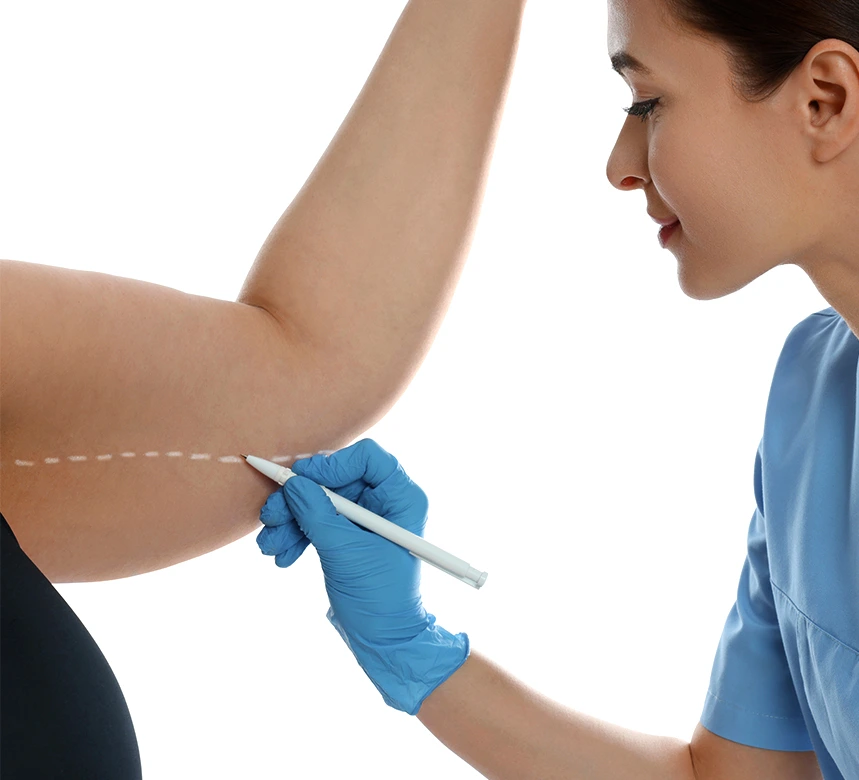 An Overview of Arm Liposuction