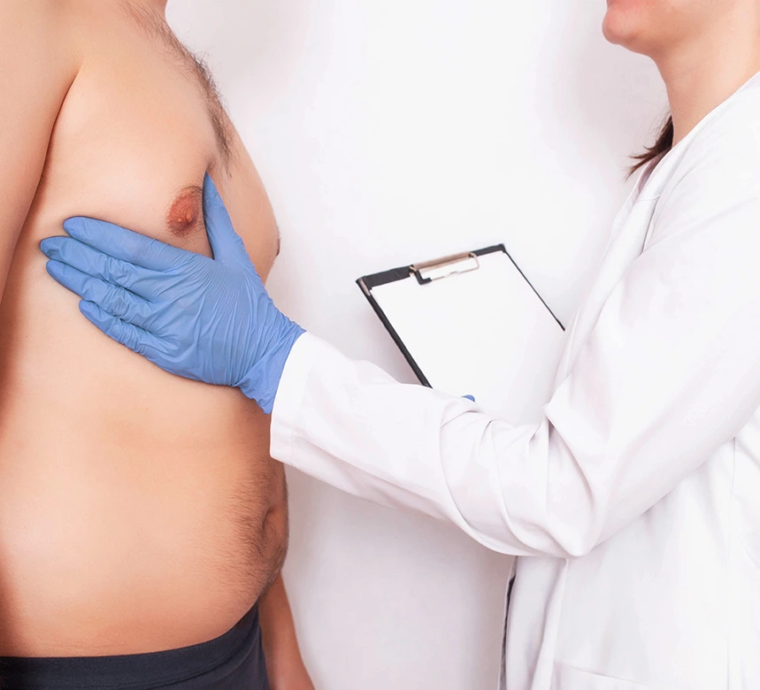 An Overview of Gynecomastia