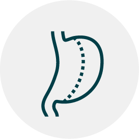 gastric sleeve icon
