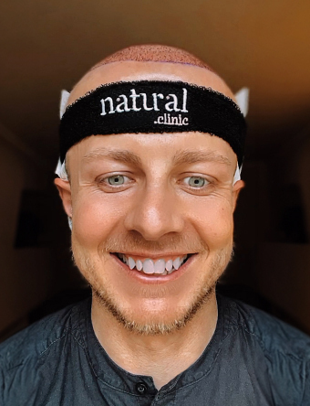 Natural Clinic - First few days after Hair Transplant , Post-Hair Transplant Care: Key Tips for the First Few Days After Surgery by Natural Clinic