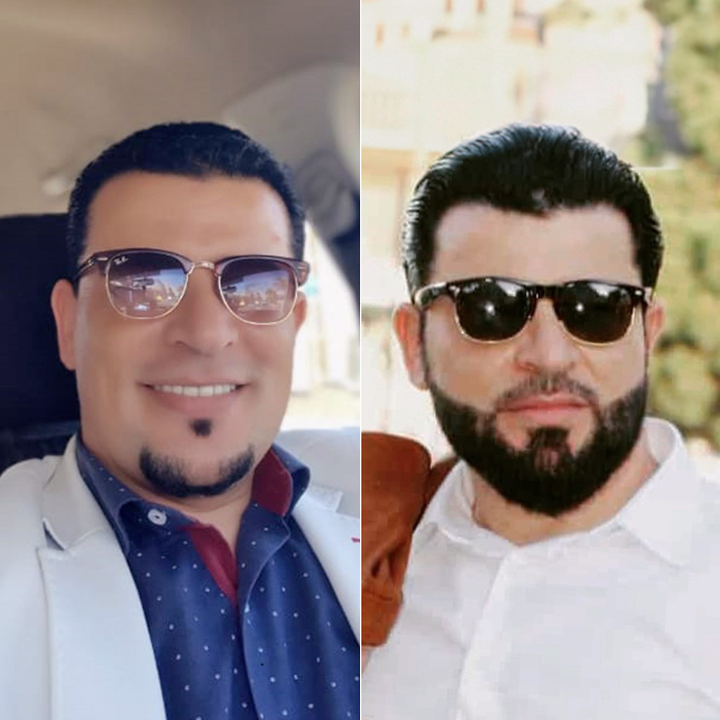 Beard transplantation in turkey before and after