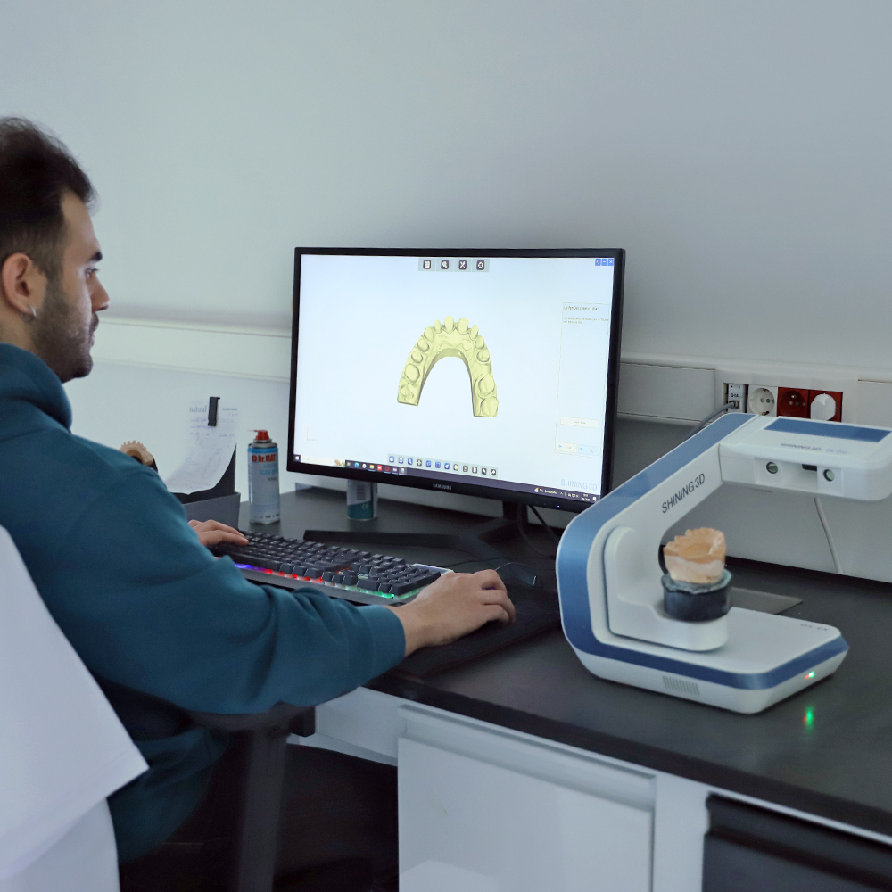 3D orthodontic analysis performed at Natural Clinic for accurate dental crown fitting