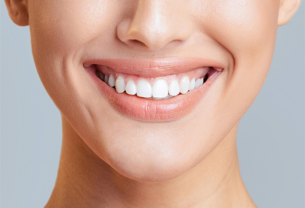 Smiling woman illustrating best veneer options at Natural Clinic in Turkey