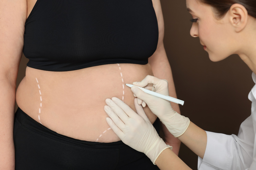 : A doctor examining a patient's abdomen before gastric sleeve surgery