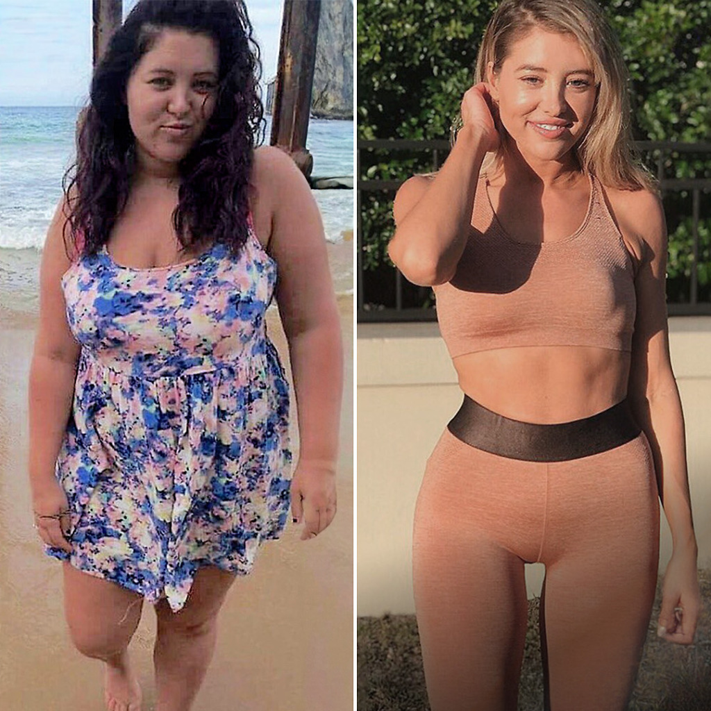 Gastric Sleeve Before & After 15