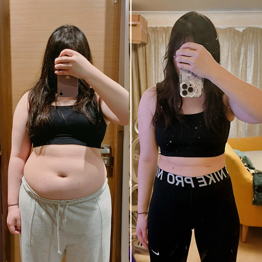 Gastric Sleeve Before & After 5